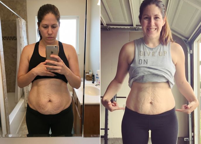 Before and after — Mira L.