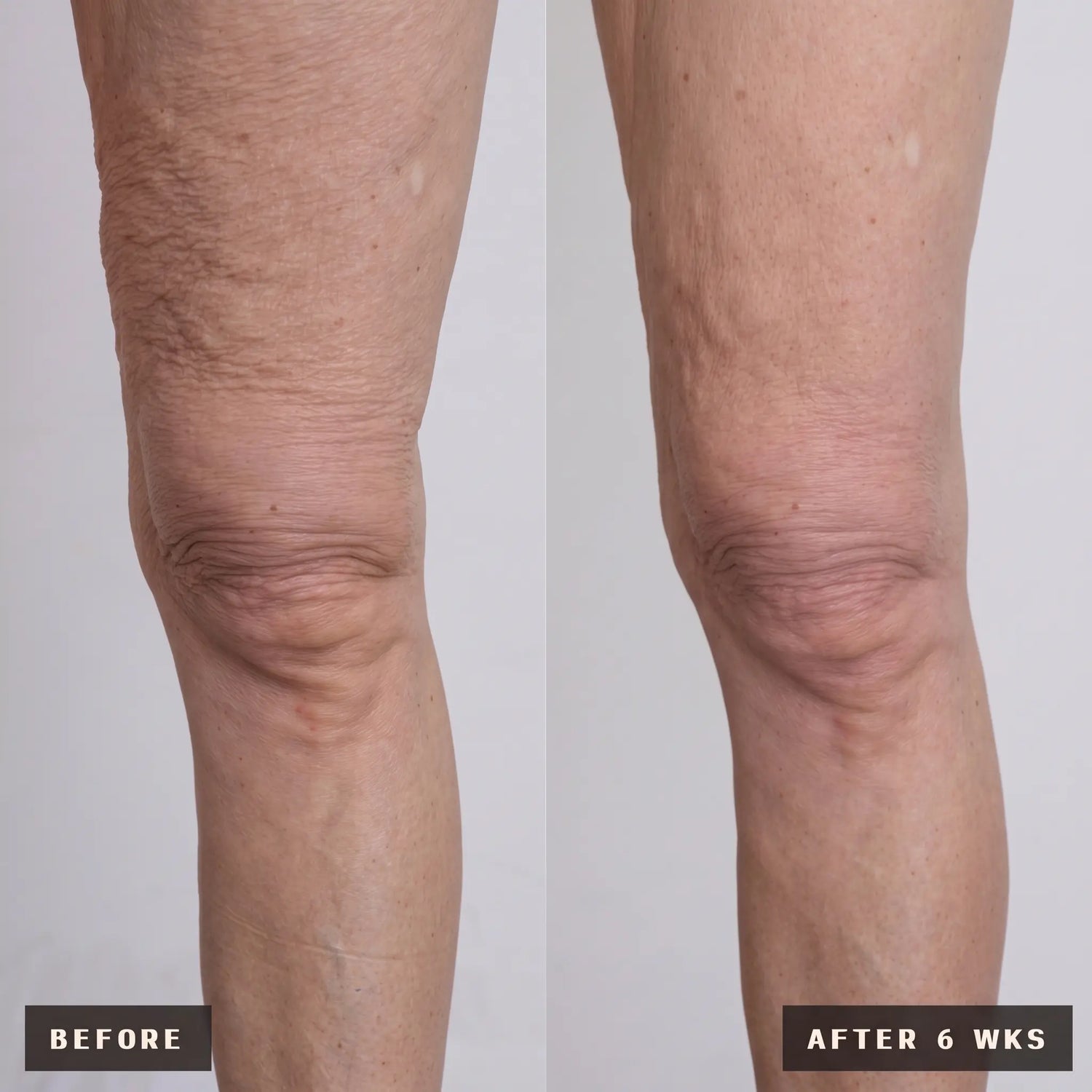 arms skin transformation in 4 weeks