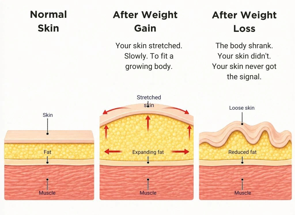 Diagram of the wound-healing cascade and the trigger that starts it.